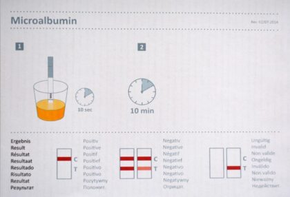 Test Microalbúmina en orina, tiras reactivas - Imagen 3